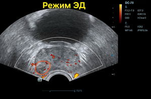 ТРУЗИ, режим ЭД